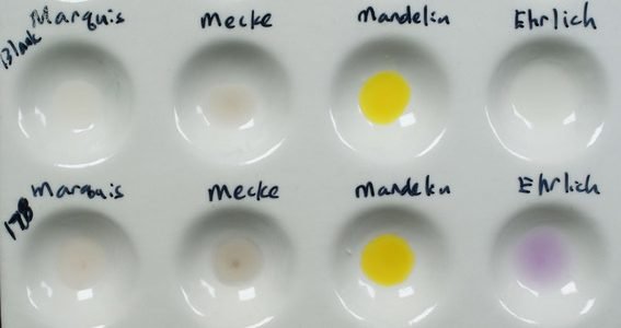 red star micro dot lsd positive